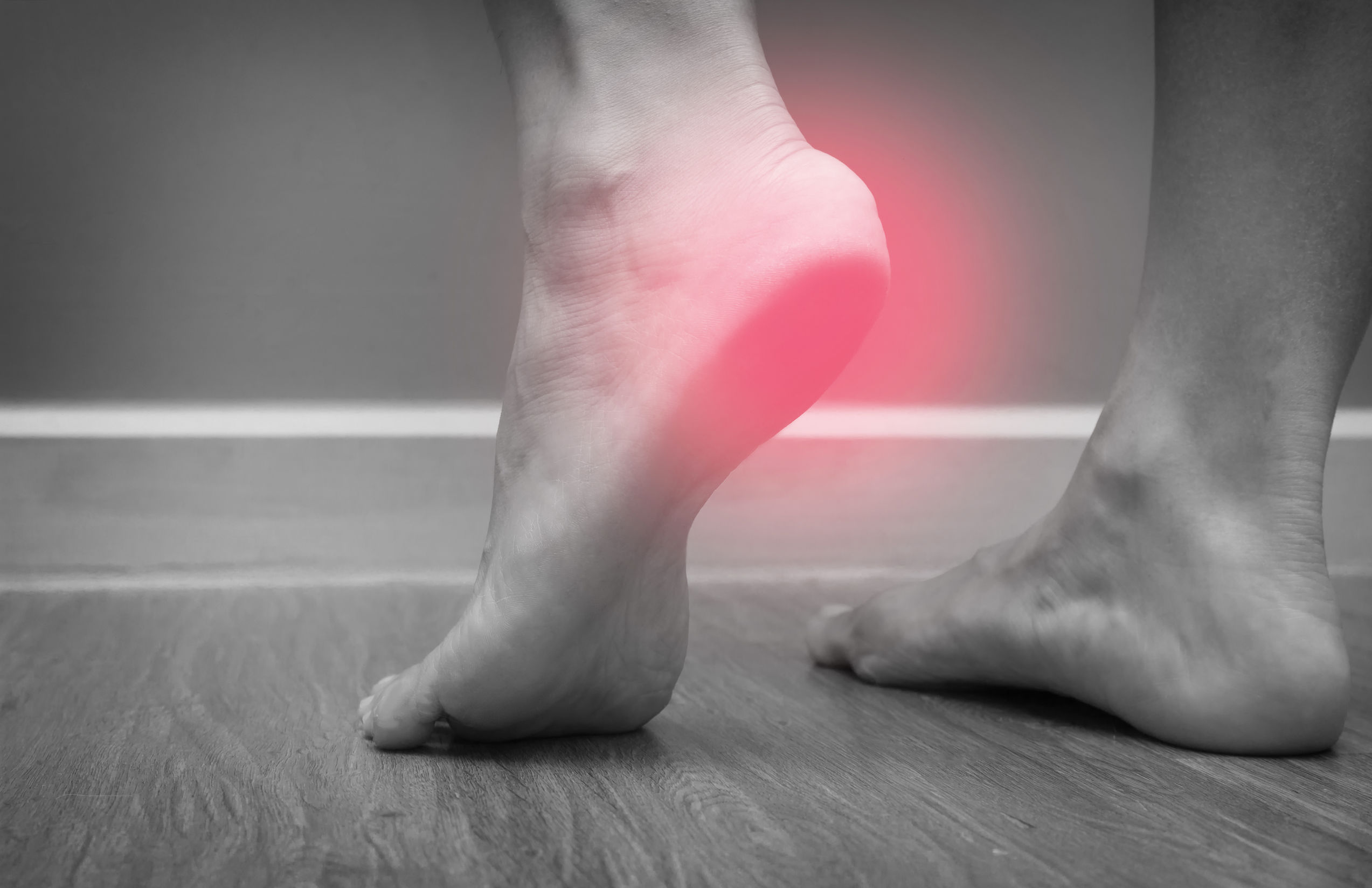 Plantar Fasciitis illustrated in black and white photo with red highlight