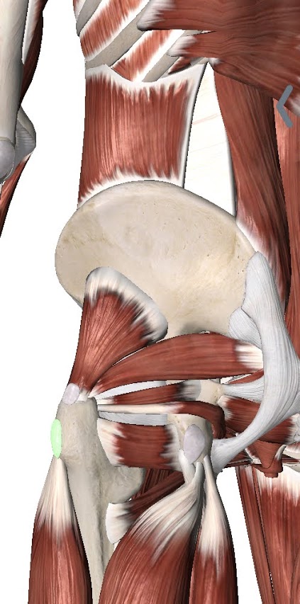 Greater Trochanteric Bursitis