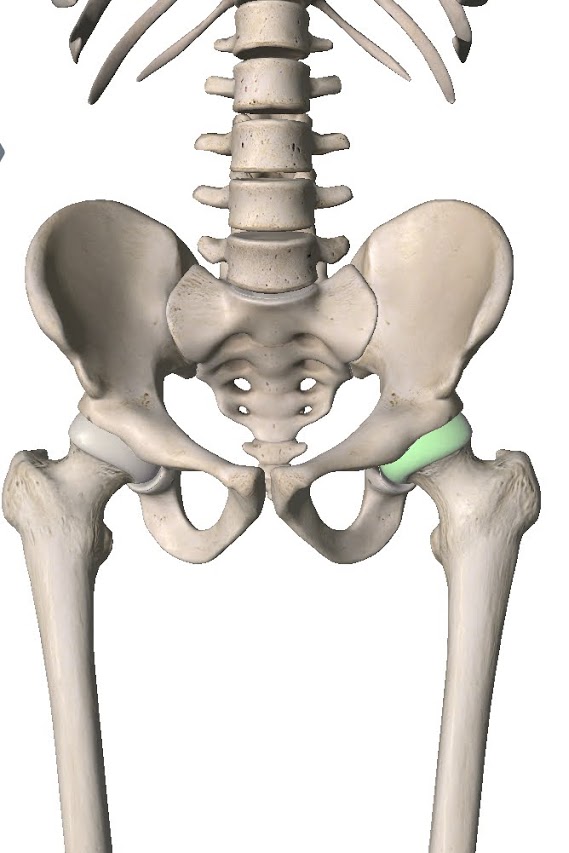 Hip Osteoarthritis