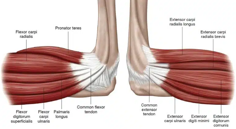 Golfers Elbow